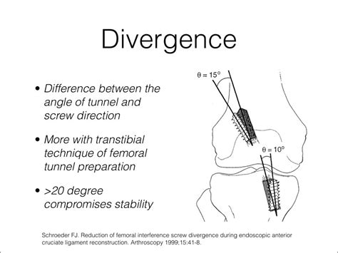 Acl graft fixation options