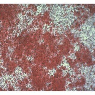 Alizarin Red S (2%, pH 4.2) staining was performed on cells incubated ...