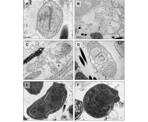 Merogony and pre-sporogony of Nadelspora-like lineage in the... | Download Scientific Diagram