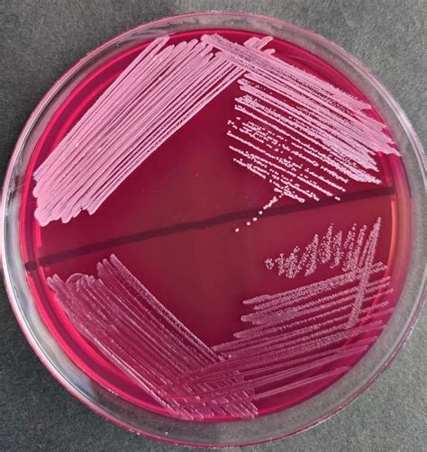 MacConkey Agar: Composition, Uses, Colony Characteristics