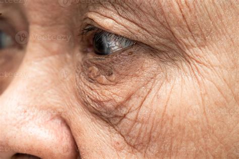 Asian elderly woman face and eye with wrinkles, portrait closeup view ...