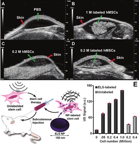 In vivo ultrasound images and quantification of cells echogenicity. In... | Download Scientific ...