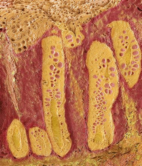Uterus endometrium, SEM - Stock Image - C048/6370 - Science Photo Library