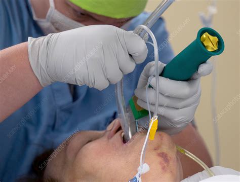 General anaesthesia intubation - Stock Image - C029/9023 - Science Photo Library