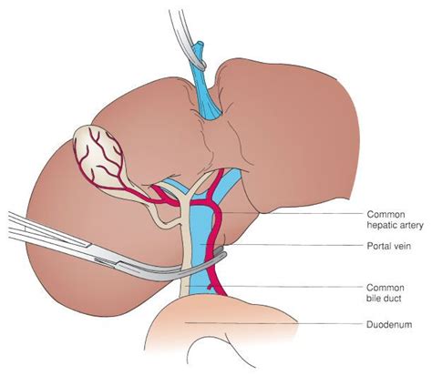 Portal Triad Gross Anatomy