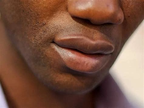 Black Lips Due To Smoking Treatment | Lipstutorial.org