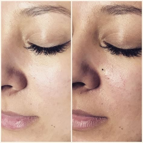 Before & After Photos of Permanent Makeup and Microblading ...