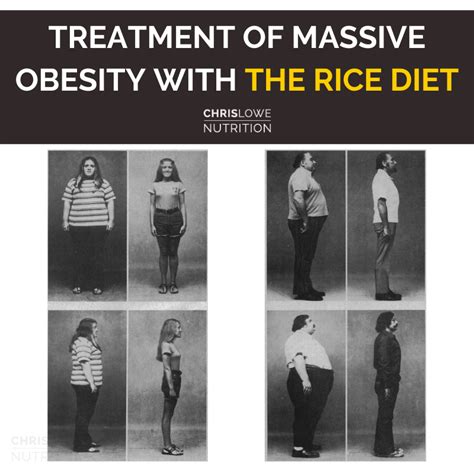 Ep. 103 - Dedication to Education: Treatment of Massive Obesity with ...