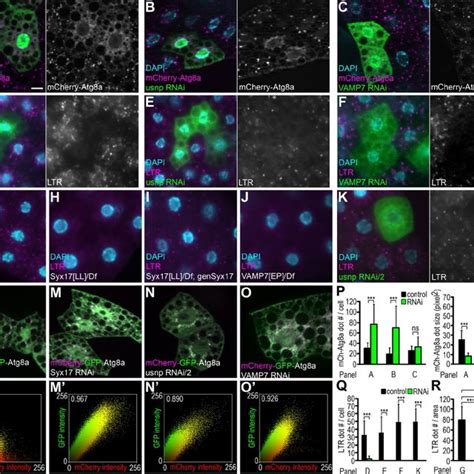 Endosome maturation, autophagosome formation, and fusion with lysosome ...