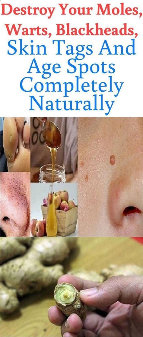 THE BEST NATURAL AND MOST EFFECTIVE NATURAL REMEDIES TO REMOVE BROWN ...