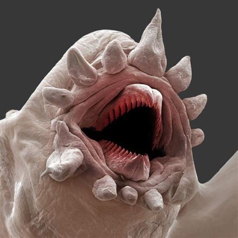 Tapeworm Under A Microscope