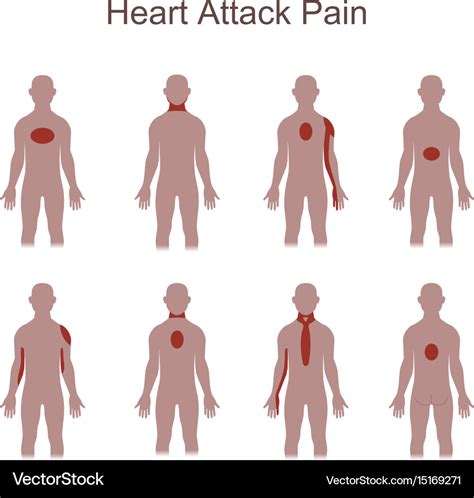 Heart attack pain location Royalty Free Vector Image