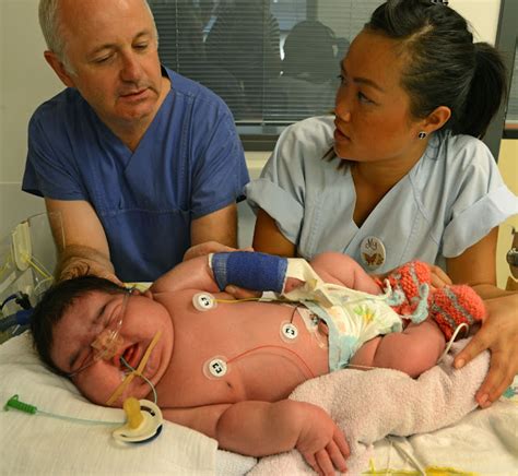 Le Plus Gros Bebe Du Monde 20 Kg - Esam Solidarity™.