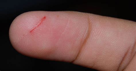 A Doctor Finally Tells Us The Reason Why Paper Cuts Hurt So Much? | ThatViralFeed