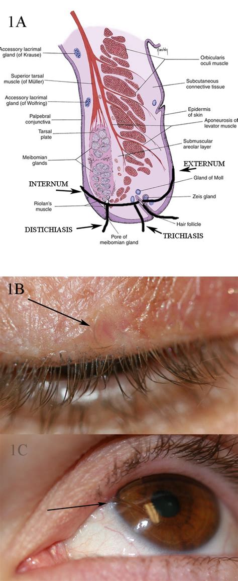 [Figure, 1A: shows the different orientations...] - StatPearls - NCBI ...