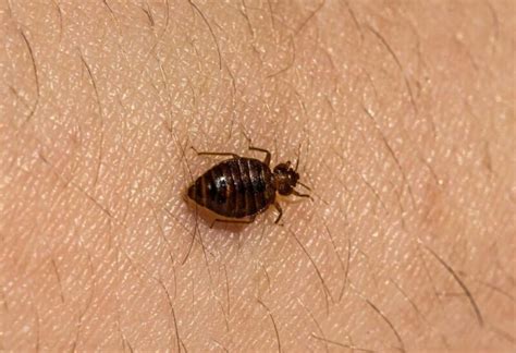 Dust Mite Bites vs. Bed Bug Bites | What’s the Difference? - peSTopped
