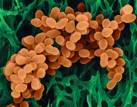 Staphylococcus aureus, SEM - Stock Image - C032/2550 - Science Photo Library