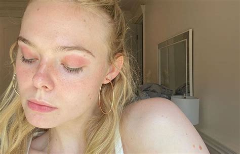 Elle Fanning Shares Photos Of Eczema Outbreak On Eyelids