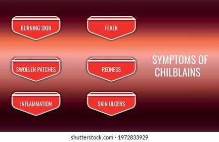 Symptoms Chilblains Vector Illustration Medical Journal Stock Vector ...