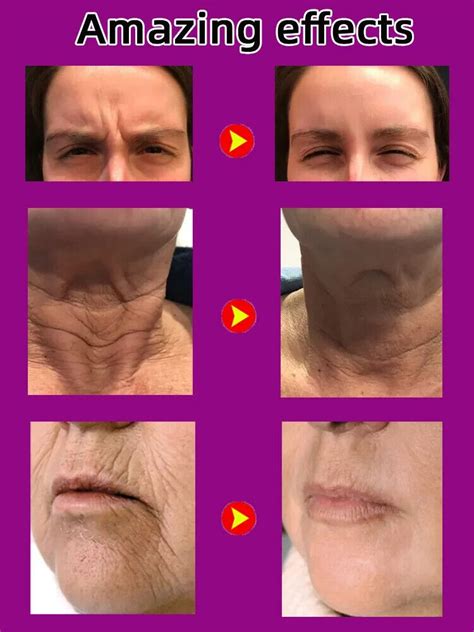 Best Anti Wrinkle Serum Remove Facial Neck Forehead Wrinkles Photo Rejuvenation | eBay