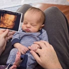 Where can i get a 3d ultrasound near me | Syair Sydney