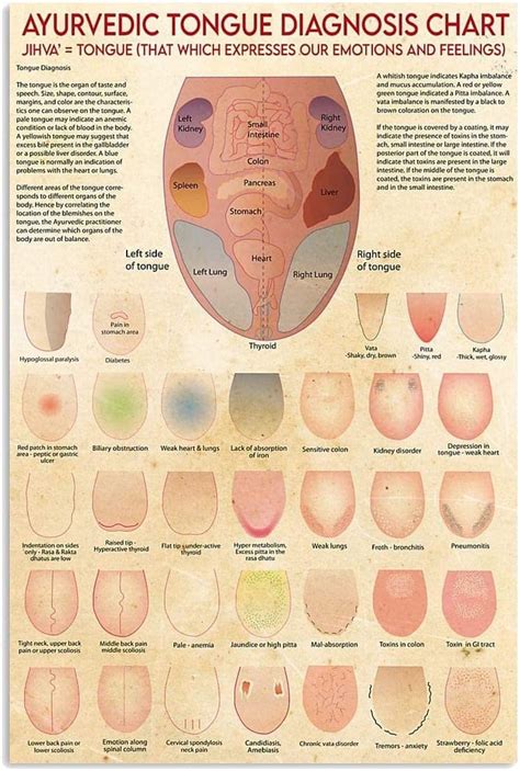 Amazon.com: Starotore Ayurveda Tongue Diagnosis Chart Metal Sign Wall ...