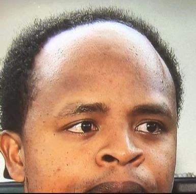 I found jidions hairline!!!!! : r/JiDion