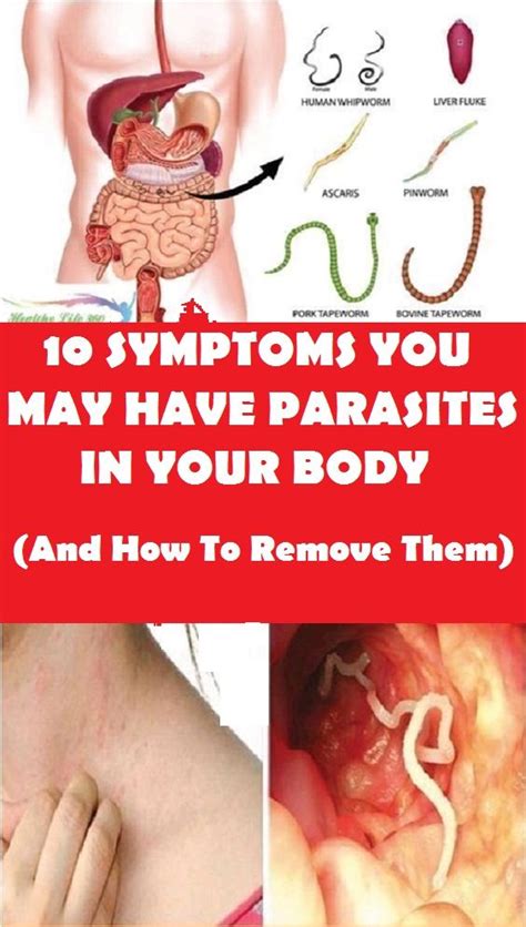 10 Symptoms You Have Parasites In Your Body And How To Remove Them ...