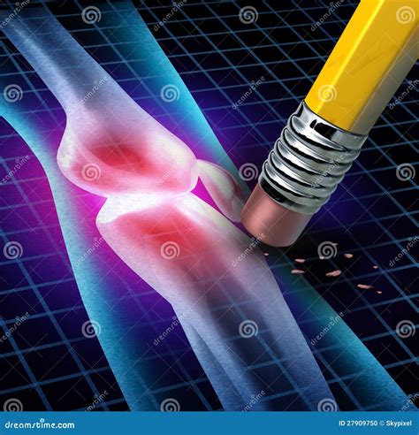 Human Knee Pain Relief stock illustration. Illustration of joint - 27909750
