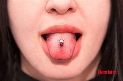 Tongue and lip piercings may damage teeth and gums - Dentistry