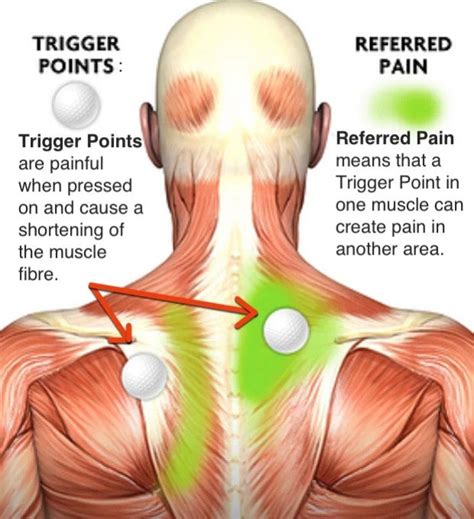 Everything You Need To Know About Trigger Point Massage, 49% OFF