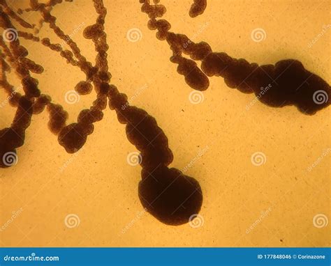 Fungi and Bacteria Under the Microscope Stock Photo - Image of ...