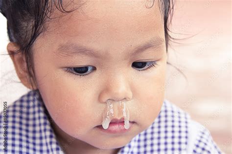 little girl with snot flowing from her nose Stock-Foto | Adobe Stock