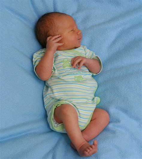 Newborn Jaundice: Signs, Causes, Treatment, And Prevention