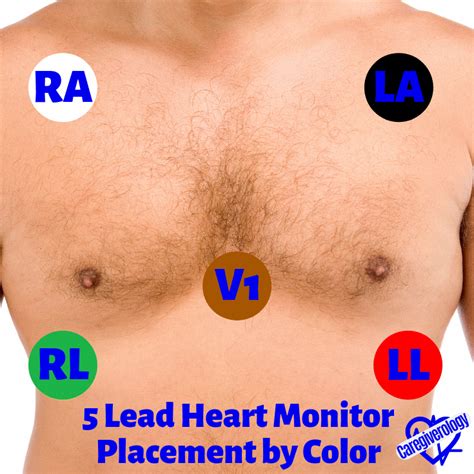 Heart Monitor Basics and Troubleshooting - Caregiverology | Heart ...