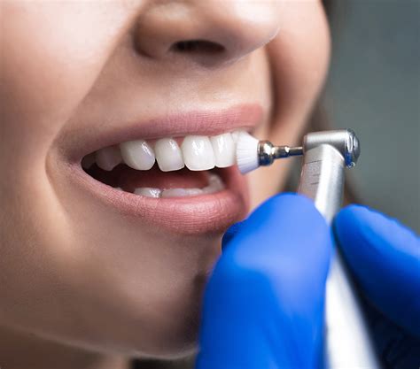 Professional Teeth Scaling & Polishing in Singapore | Dental Cleaning