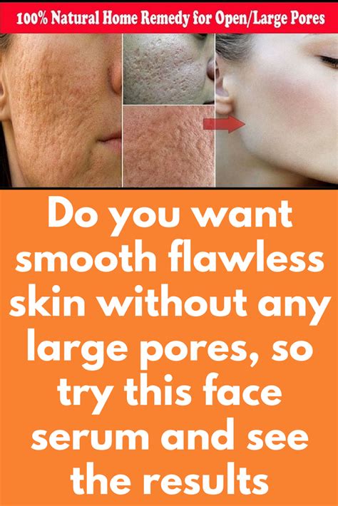 Do you want smooth flawless skin without any large pores, so try this face and see the instant ...