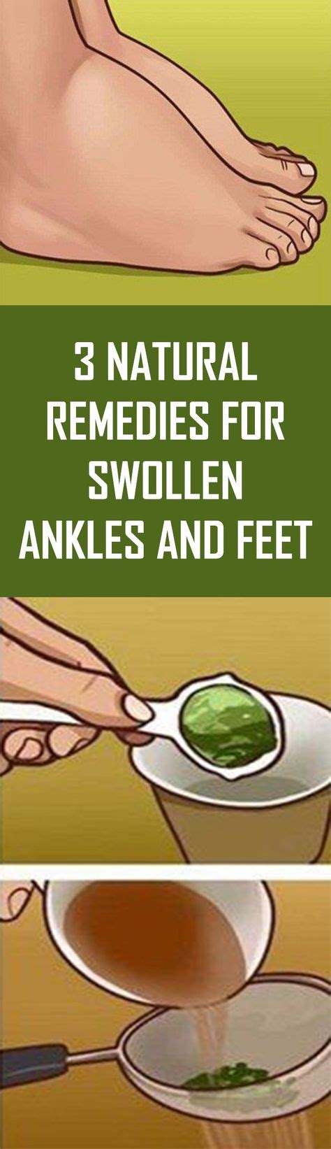 3 Natural Remedies For Swollen Ankles and Feet, #body #Care #feetcare # ...