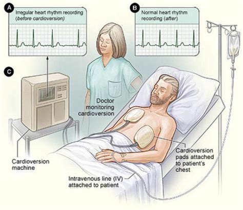 Cardiac Arrhythmia Treatments/Procedures - Phoenix, AZ & Tempe, AZ: Arizona Heart Arrhythmia ...