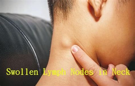 Top 17 lymph nodes side of neck 2022