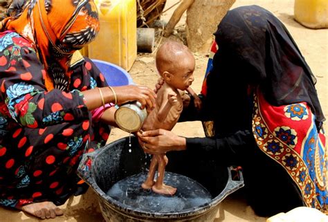 Yemenis turn to boiled leaves as famine grips the region