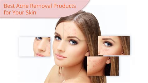 What's The Best Acne Removal Product For You? We Have The Answer.