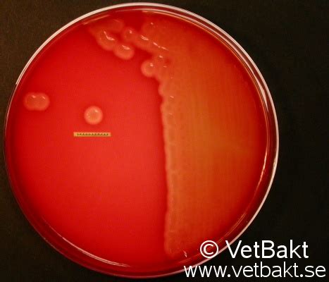 Streptococcus equi subsp. zooepidemicus