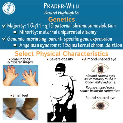 Pathology Glossary: Prader-Willi Syndrome | Draw It to Know It