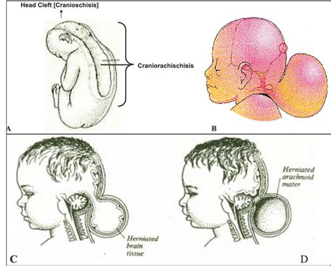 No.I A. Cranio Facio Cervical (Branchial) Clefts 1. Soft tissue Group ...