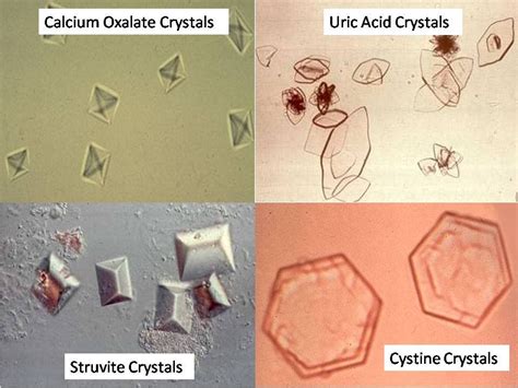 kidney stone shapes - Google Search Vet Tech School, Vet Tech Student, Veterinary Tech ...