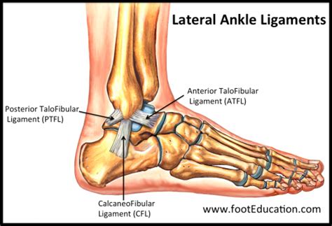 Why an ATFL Rupture does not need surgery - Body Focus Physiotherapy