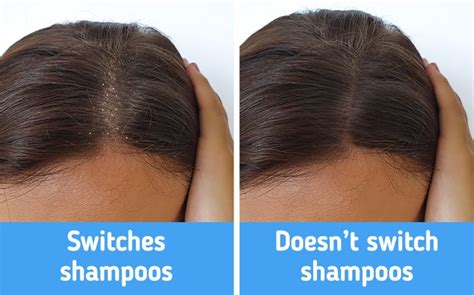 10 Mistakes to Avoid for a Healthy Scalp and Hair / Bright Side