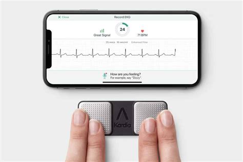 Kardia Personal EKG