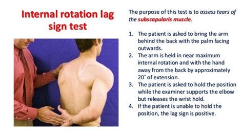 02. shoulder examination